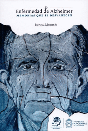 ENFERMEDAD DE ALZHEIMER